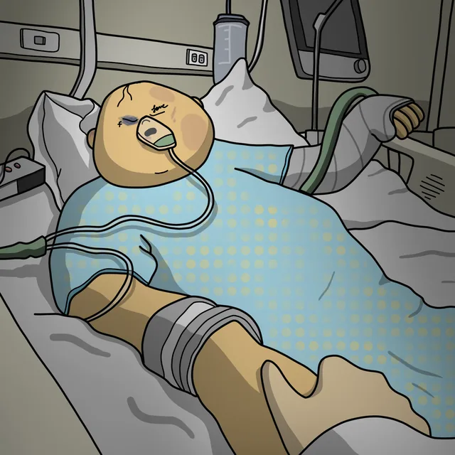 Coma