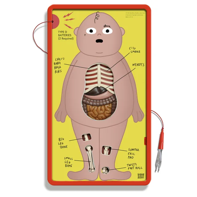 Nancy Operation